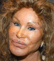 Jocelyn Wildenstein